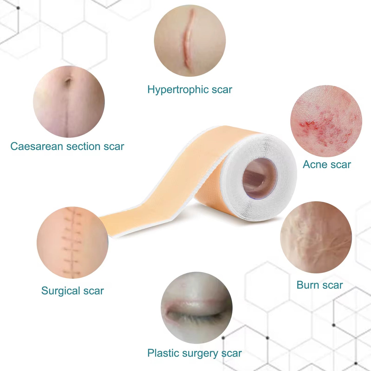 Elaimei - Silicone Scar Removal Tape