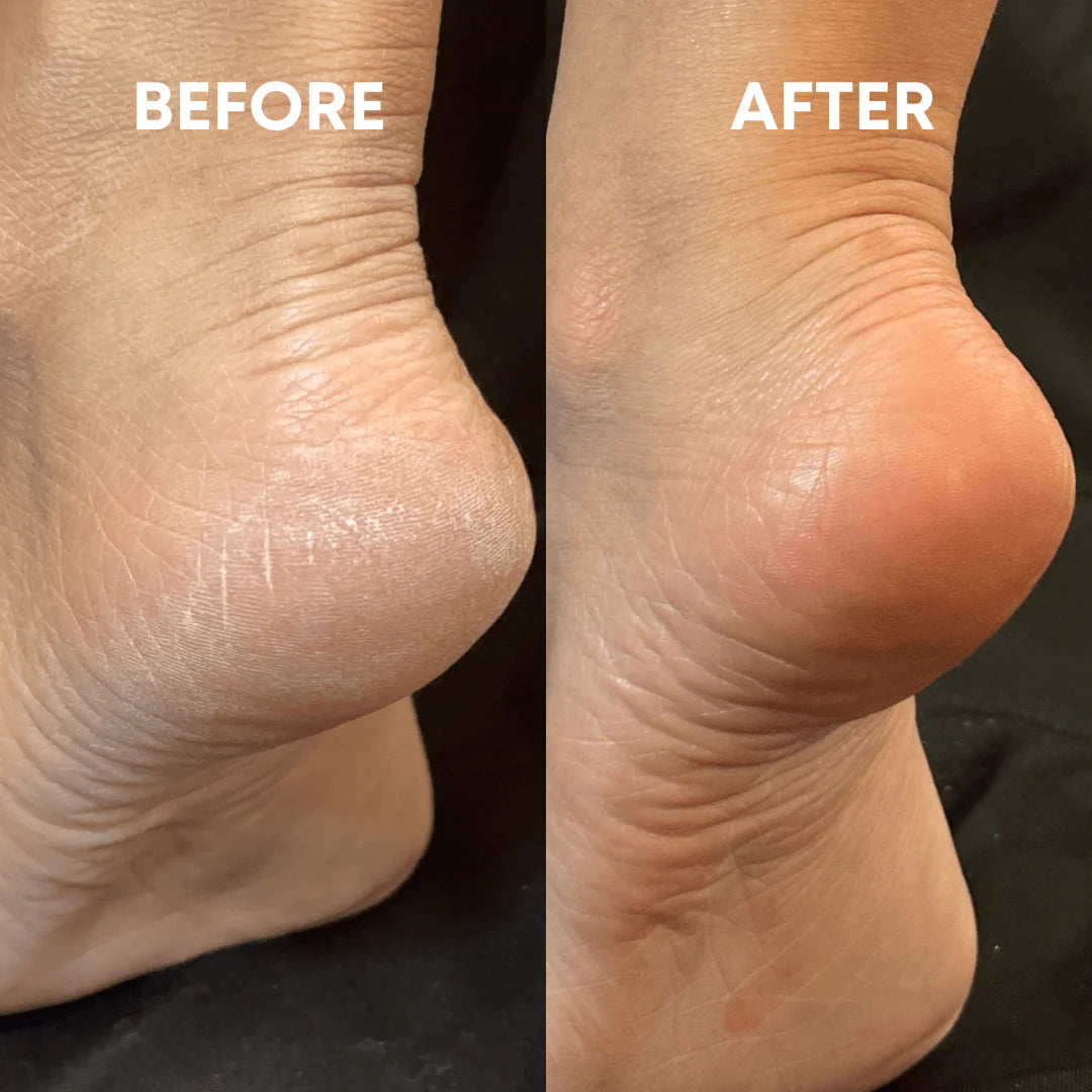 Solveskin - Glass Foot File