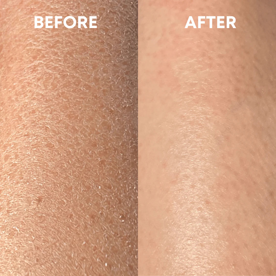 Solveskin - Exfoliating Glove