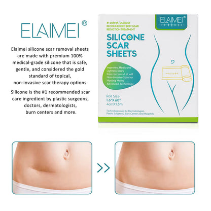 Elaimei - Silicone Scar Removal Tape